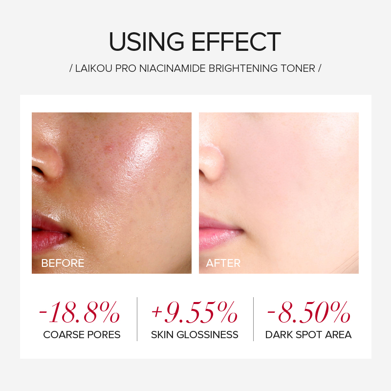 LAIKOU PRO Niacinamide 4Pcs Br - đánh giá và giá Niacinamide Brightening Serum