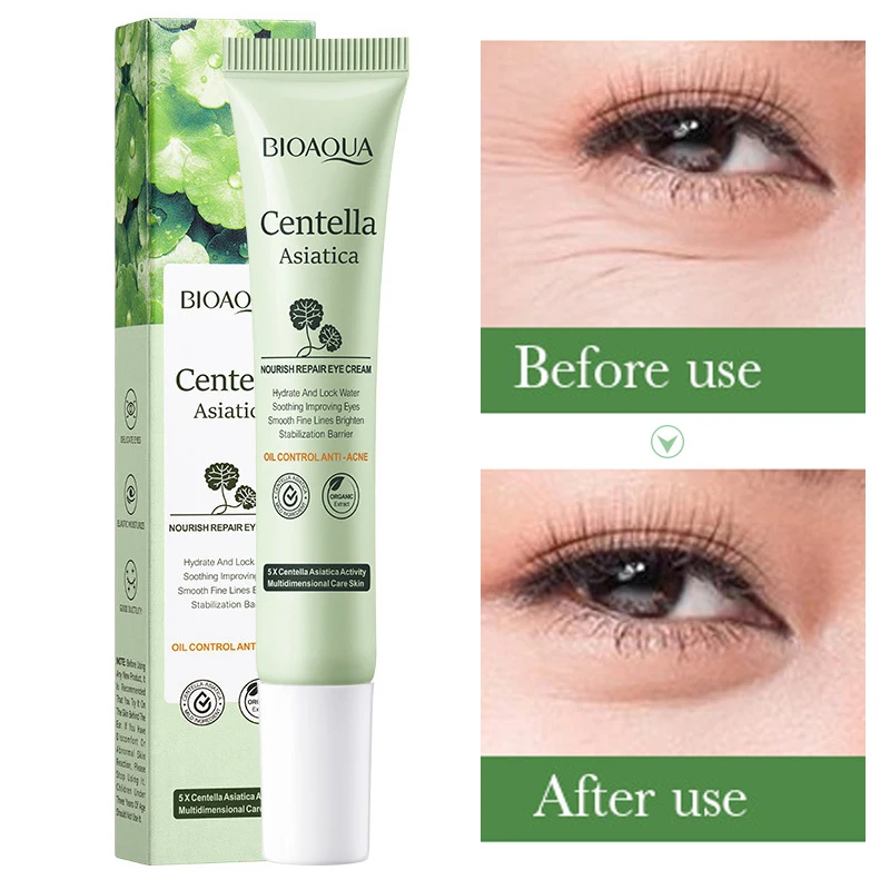 Centella Asiatica Eye Cream Mo - đánh giá và giá Centella Asiatica Toner