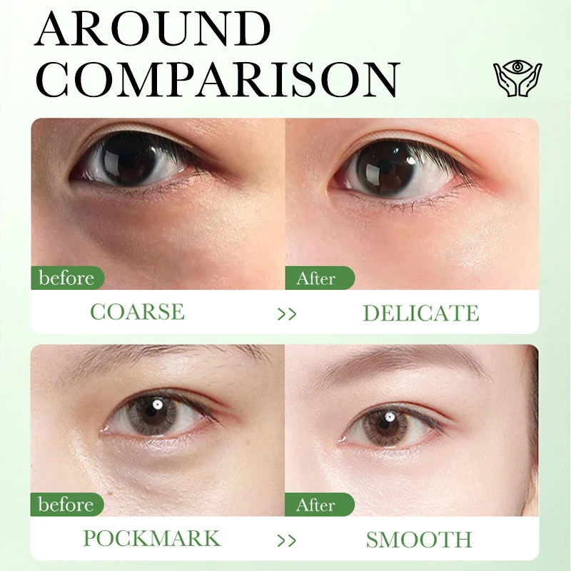 Centella Asiatica Eye Cream Mo - đánh giá và giá Centella Asiatica Toner