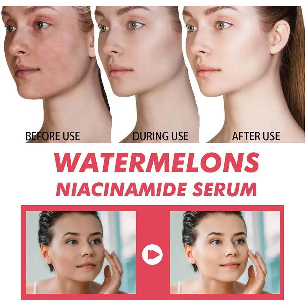 Watermelon Glow Niacinamide Mo - đánh giá và giá Niacinamide Brightening Serum