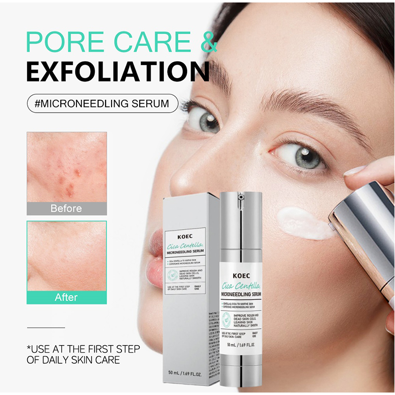 Soothing Microneedle Serum, Ce - đánh giá và giá Centella Asiatica Toner