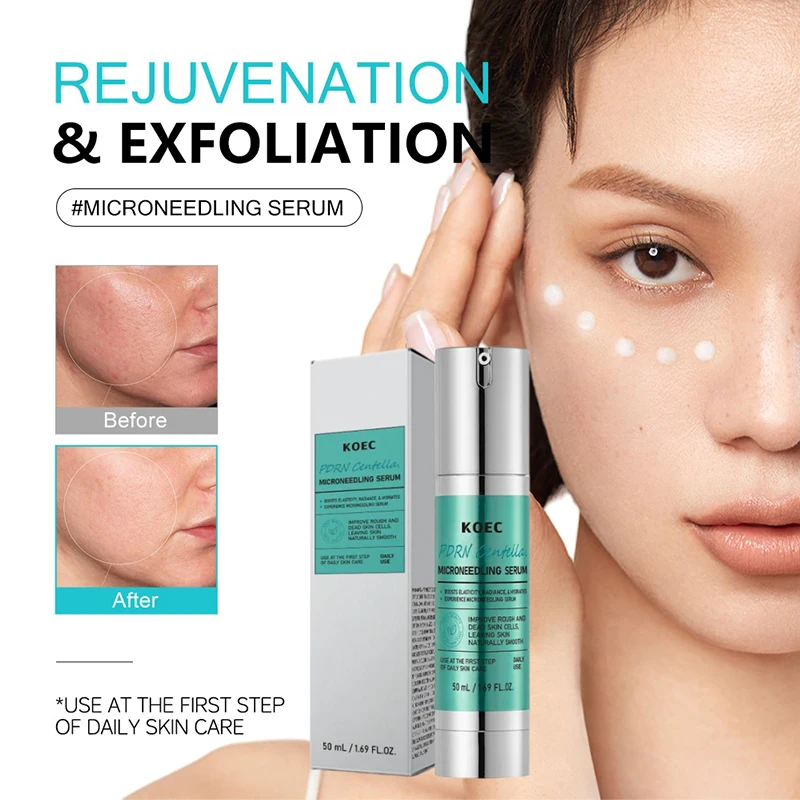 Soothing Microneedle Serum, Ce - đánh giá và giá Centella Asiatica Toner