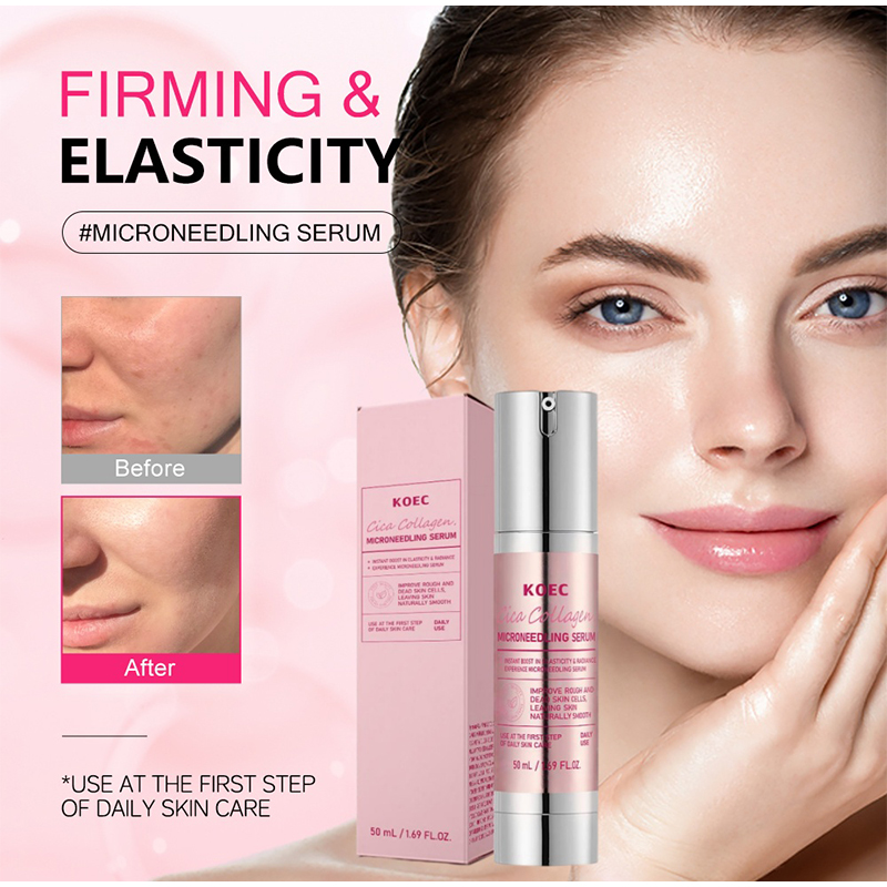 Soothing Microneedle Serum, Ce - đánh giá và giá Centella Asiatica Toner