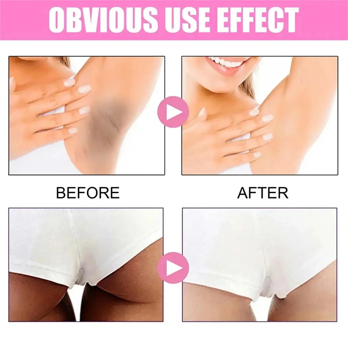 Whitening Cream Private Parts  - đánh giá và giá Niacinamide Brightening Serum